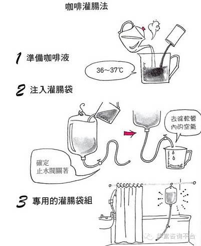 姜汤灌肠参考：什么是咖啡灌肠？为什么大家都在用？（超级震撼）