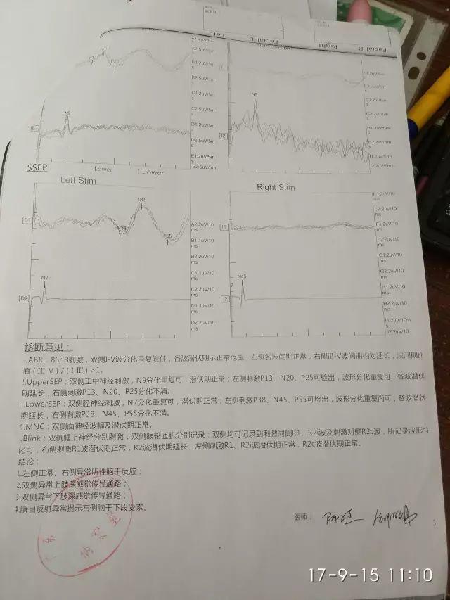 原始点调理脑胶质瘤：告别风雨见阳光