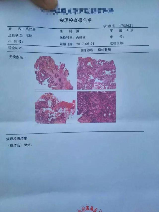 原始点调理结肠癌：不及是缺少，过量是消耗