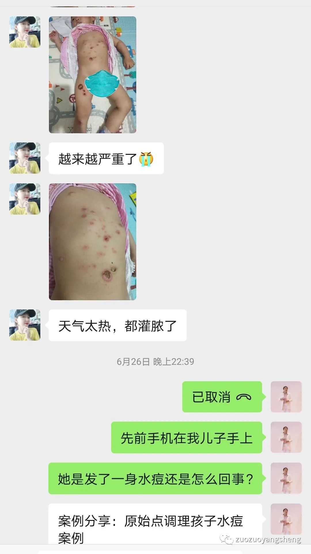 案例分享：原始点调理两岁儿童全身脓包溃烂流脓案例。