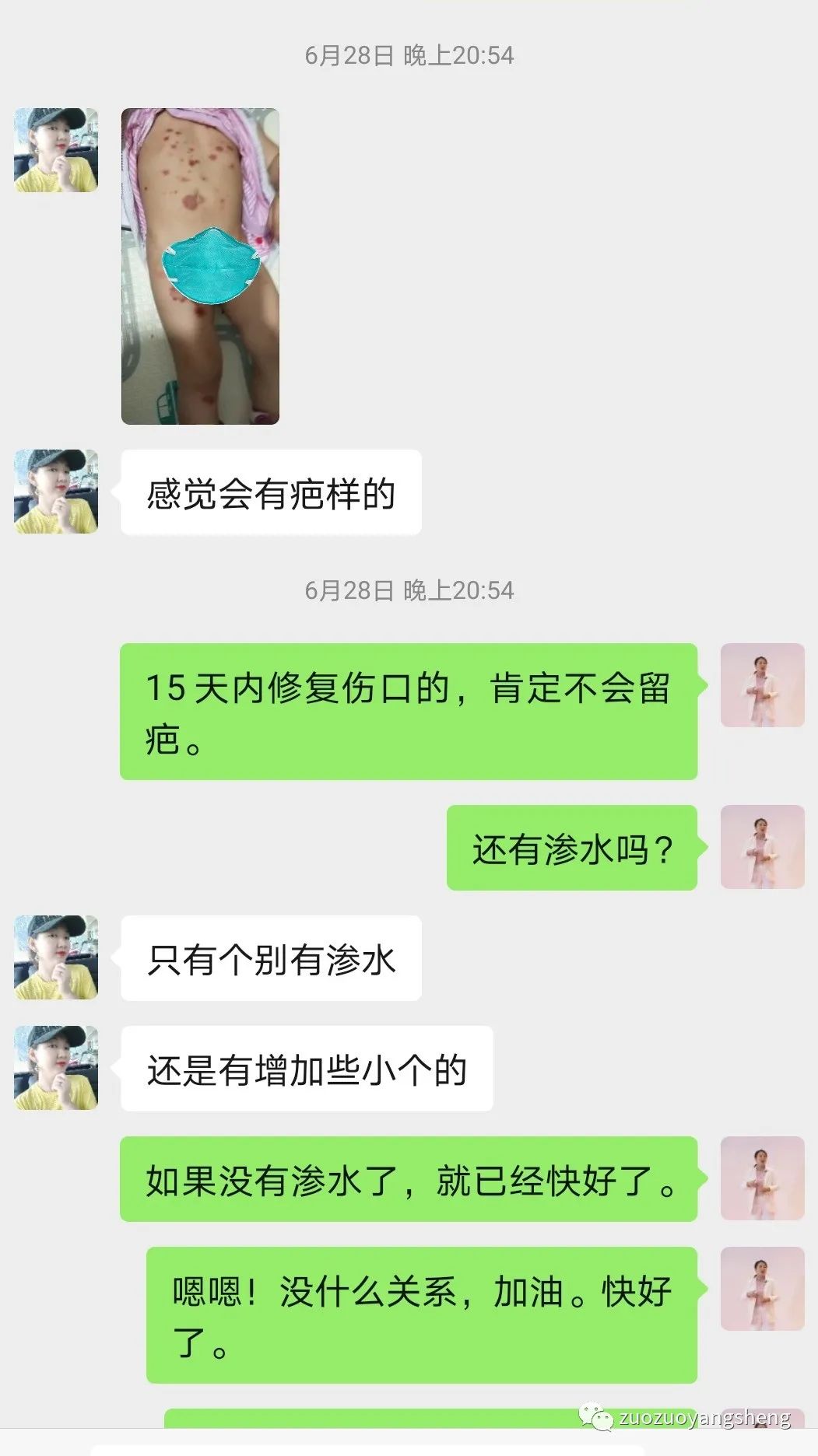 案例分享：原始点调理两岁儿童全身脓包溃烂流脓案例。